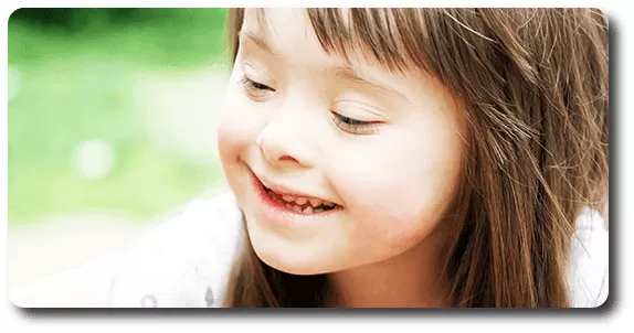 educacion inclusiva sindro de down